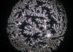 bormia untersuchung 2 nadeen althoff