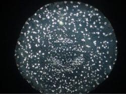 bormia untersuchung 2b nadeen althoff