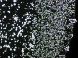 bormia untersuchung 2cnadeen althoff