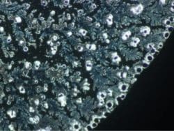 bormia untersuchung 2d nadeen althoff