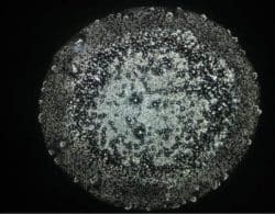 bormia untersuchung 2a nadeen althoff